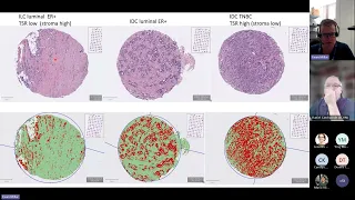 Statewide Biobank Seminar Series - A/Prof Ewan Millar: AI in Anatomical Pathology