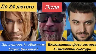 Олег Винник свіже фото, що із обличчям артиста, Наталка Денисенко на морях, Мірзоян Єфросініна пнх