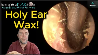 HOLY EAR WAX! 246 #ear #earwax #earwaxremoval #earcleaning #earwaxclinic #asmr #fyp #satisfying