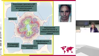 Школа врача-интерна. «Современные аспекты диагностики и терапии ХОБЛ в ОВП»