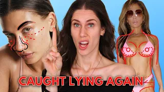 Celebrities Caught Lying About Plastic Surgery Wern't Wrong...