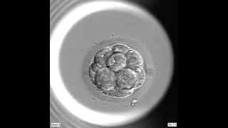 Zu Beginn des Lebens: Die ersten Schritte von der befruchteten Eizelle zum Embryo