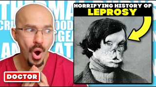 DOCTOR Reacts to The Horrifying History of LEPROSY
