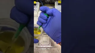 Urine Drug Screen: How it’s Done 🧪