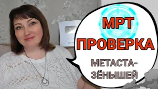 Результат свежей МРТ головного мозга. Пункция позади.