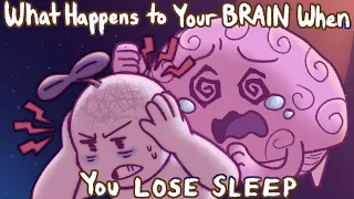 What Happens To Your Brain If You Don't Sleep