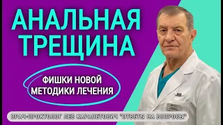 АНАЛЬНАЯ ТРЕЩИНА: как мы лечим её сегодня (фишки новой методики)