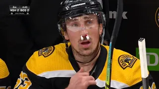 Brad Marchand's nose can't catch a break