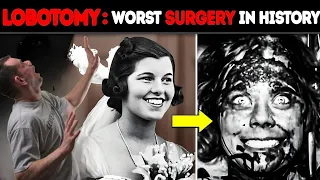 This Is Why LOBOTOMY Is The Worst Surgery In History