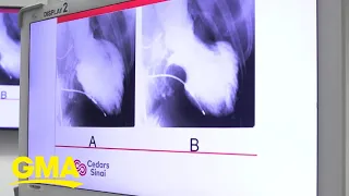 'Broken heart' cases spike during COVID