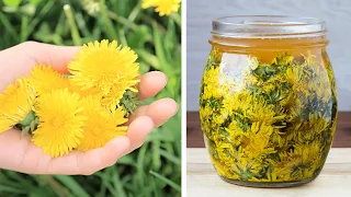 9 Ways To Use Spring Dandelions
