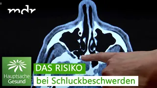 Erstickungsgefahr: Warum Schluckbeschwerden lebensbedrohlich sein können | Hauptsache gesund | MDR