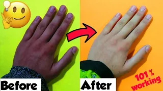 How to get white skin in just 7 days || Sajal's Art