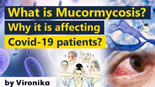 What is Mucormycosis? Black Fungal infection affecting Covid 19 patients in India