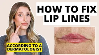 How to Fix Lip Lines | Dermatologist Shares Treatments for Lip Wrinkles