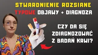 Jak wykluczyć albo potwierdzić stwardnienie rozsiane? Pierwsze objawy typowe dla SM.  | O, choroba!