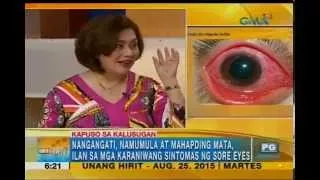 Simple ways to avoid having sore eyes | Unang Hirit