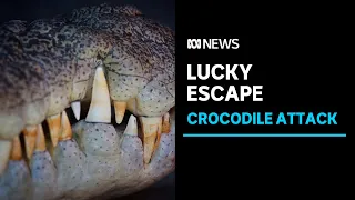 Man loses toes after stepping on saltwater crocodile's head south of Darwin | ABC News