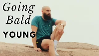 GOING BALD ADVICE FOR YOUNG GUYS