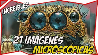 😲 21 IMPACTANTES iMaGeNeS MICROSCOPICAS 😲 IMPrESIONANTE