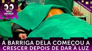 A barriga dela começou a crescer após dar à luz. Quando a operaram, os médicos ficaram chocados.