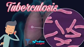 Tuberculosis | TB Pathogenesis, Symptoms, Diagnosis, Treatment