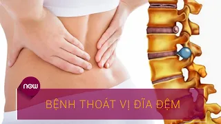 Bệnh thoát vị đĩa đệm có nguy hiểm không? | VTC Now