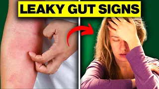 10 Signs and Symptoms of Leaky Gut