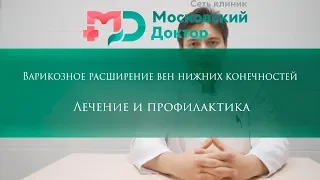 Варикоз лечение и профилактика