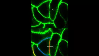 Tracking molecular movement in pacreatic cancer