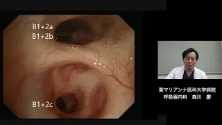 【聖マリアンナ医科大学病院】気管支鏡検査と肺癌診療の進歩　呼吸器内科森川　慶