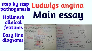 Ludwigs angina