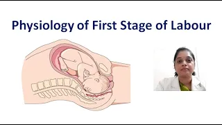 First stage of labour/Cervical Effacement/Cervical Dilatation/Uterine Action