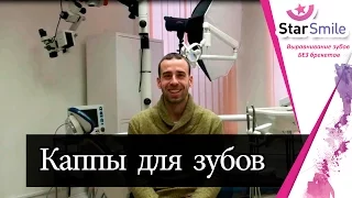 Видео отзыв пациента Антона об элайнерах Star Smile для выравнивания зубов