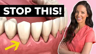 6 Ways You're Causing Gum Recession Right Now!