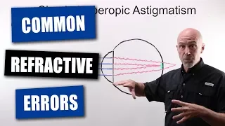 Common Refractive Errors Of The Human Eye