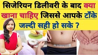 सिजेरियन डिलीवरी के बाद क्या खाये जिससे आपके टाँके जल्दी सही हो। Diet Food After C Section Delivery.