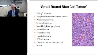 RNA-seq for the Detection of Gene Fusions in Tumors