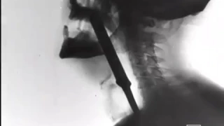 French Sword Swallower x-rayed L'avaleur de sabre  1955