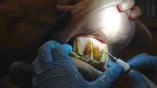 Ultrasonic scaling of a horse's teeth