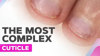 MEN'S Manicure | Badly Bitten Nails | Sensitive Cuticles