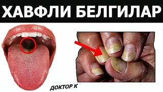 ДИҚҚАТ!!!ҚАЛҚОНСИМОН БЕЗНИНГ ХАВЛИ БЕЛГИЛАРИ.