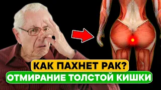 10 признаков того, что ваша ТОЛСТАЯ КИШКА ОТМИРАЕТ! 90% людей даже НЕ ДОГАДЫВАЮТСЯ об этом