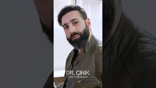 Dr.Cinik Hair Transplant | FUE | Before After 4450 Grafts | Hair Growth Results in 1 Year