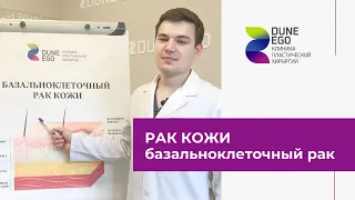 Рак кожи. Как лечат базальноклеточный рак в Новосибирске?