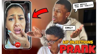 I GOT LIP "FILLERS" TO SEE HOW MY FIANCÉ WILL REACT! *BOTCHED!* | VLOGTOBER DAY 3