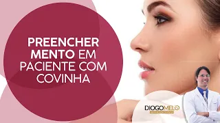 Preencher mento em paciente com covinha.