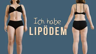 Ich habe Lipödem | Meine Geschichte, Angst vor den OPs