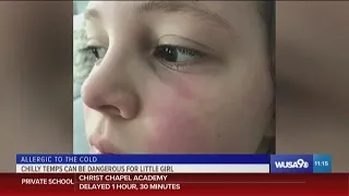 8-year-old Riley is allergic to the cold