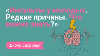 Инсульты у молодых. Редкие причины. Почему теперь это не "Болезнь старых"